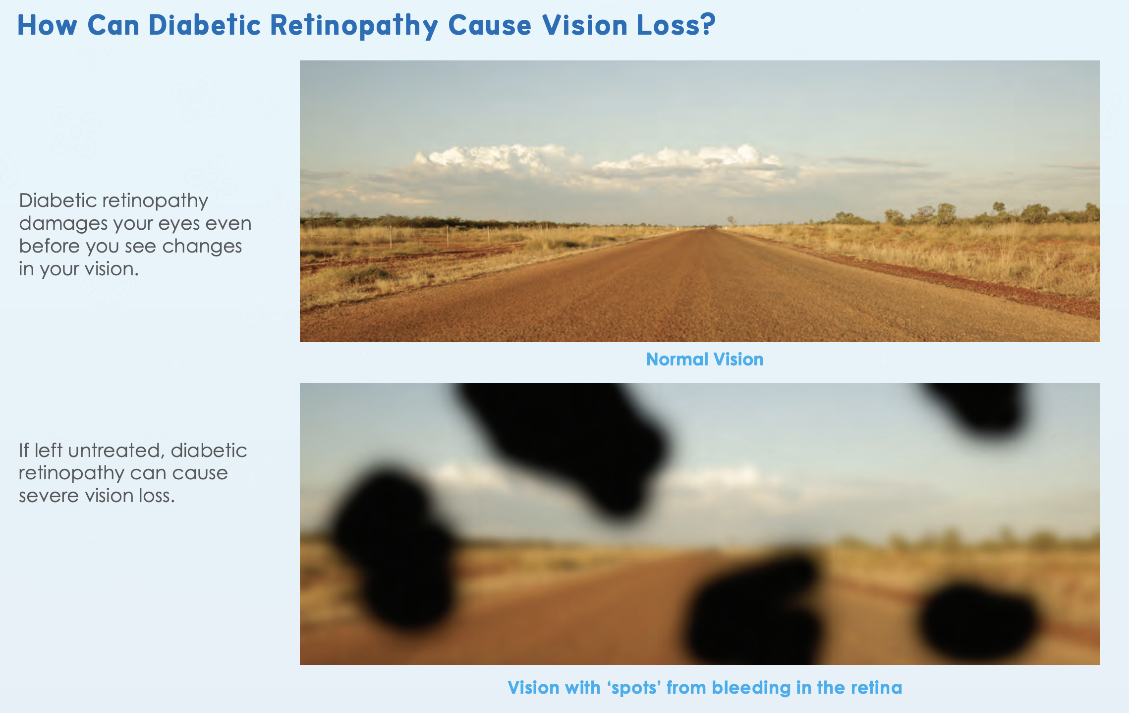 image showing a sample of vision loss- spots over the image