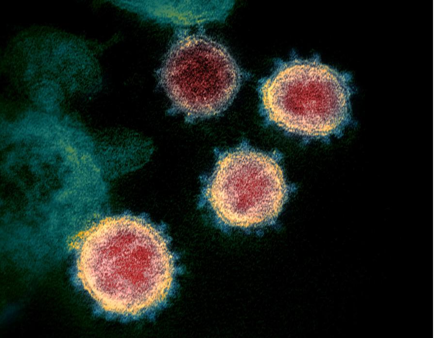 2019-nCoV the virus that causes COVID-19