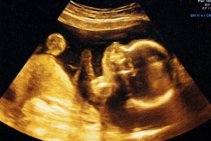 Ultrasound of a woman's fetus at 37 weeks stock pho