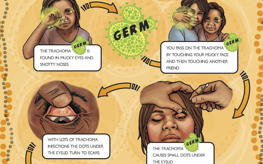 2017 trachoma germ story poster